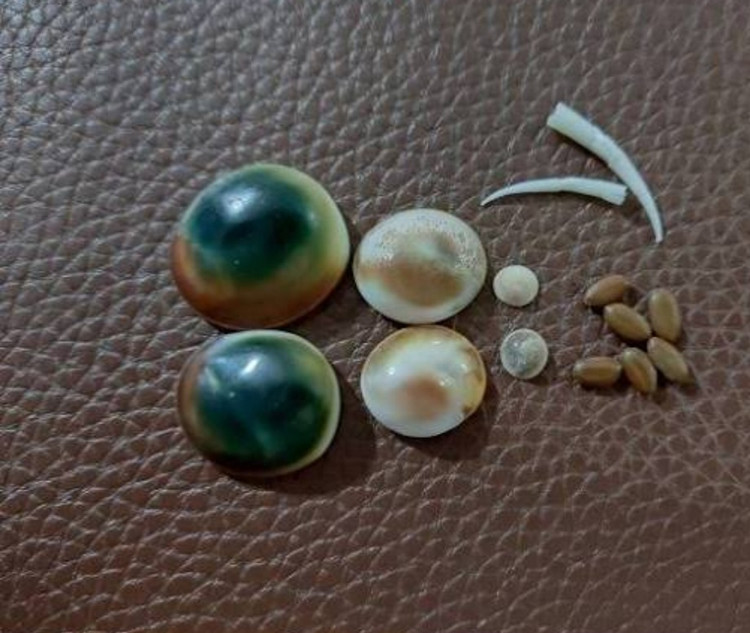 مهره مار تضمینی